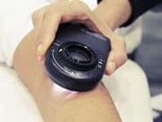 Control anual de nevus